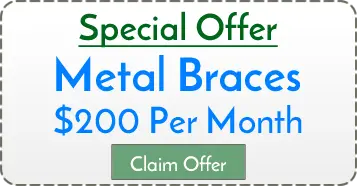 special offer metal braces